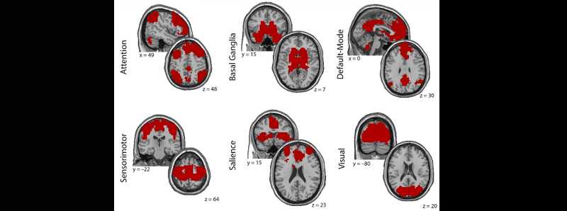 I segreti dello stress traumatico nascosto nel cervello