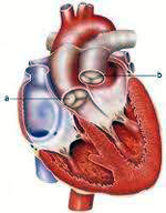 Valvola aortica transcatere