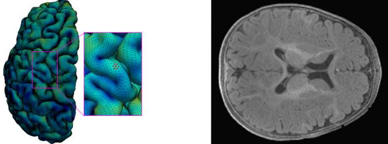 Nuova mappa della corteccia cerebrale in via di sviluppo