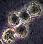 Acanthamoeba