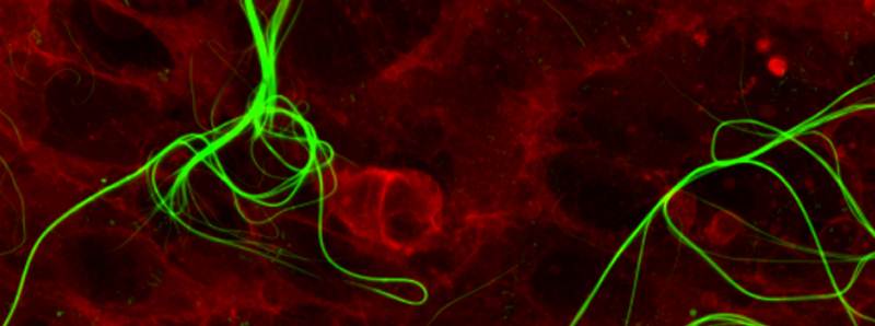 Cellule umane contenenti nanostrutture organiche