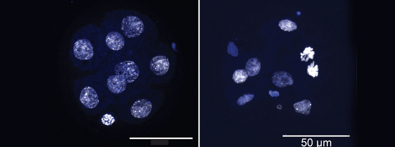 Sulle tracce di geni scomparsi e indizi sul cancro