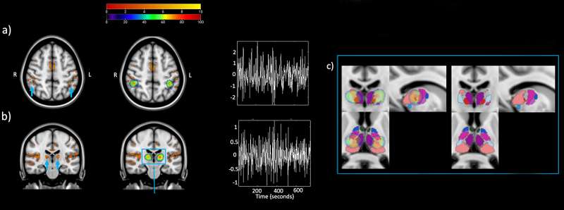 Come il nostro cervello viene stimolato dalla luce