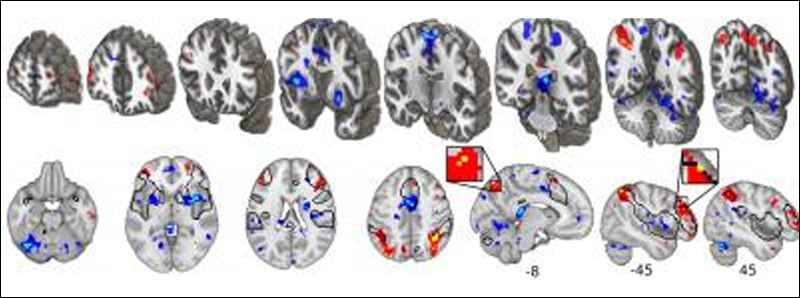 La neuroscienza degli effetti placebo