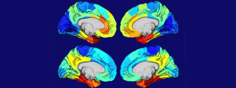 Motivo per cui l'Alzheimer danneggia parti del cervello