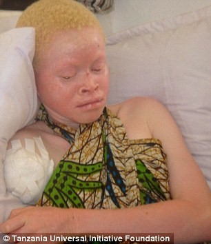 Albino africano mutilato