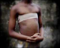 Breast ironing