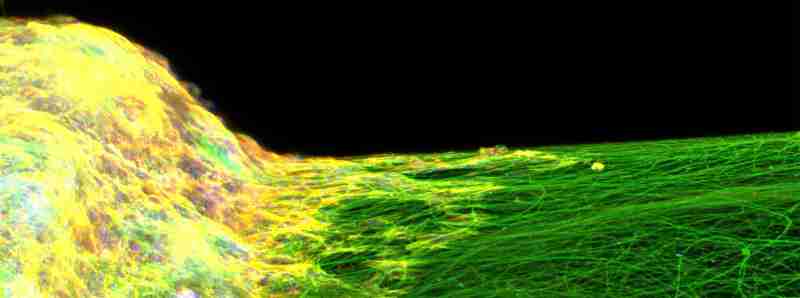 Primo modello di tessuto neurale 3D in vitro