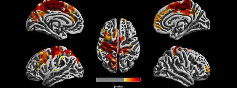 L'inquinamento muta il cervello degli adolescenti