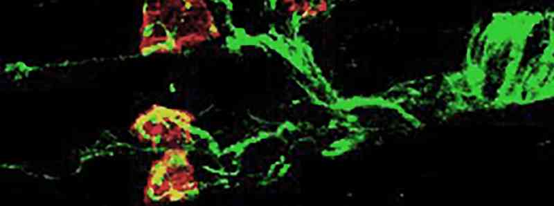 Molecola che rallenta la progressione dell'atrofia muscolare spinale