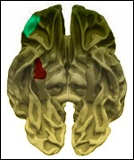 Human Connectome Project