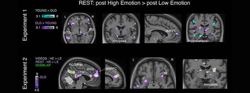 Le emozioni negative favoriscono l'invecchiamento patologico