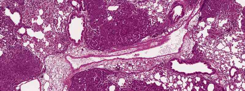 Modelli sperimentali di immunoterapia contro il cancro