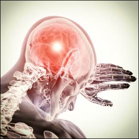 Ictus cerebrale: sintomatologia e prevenzione